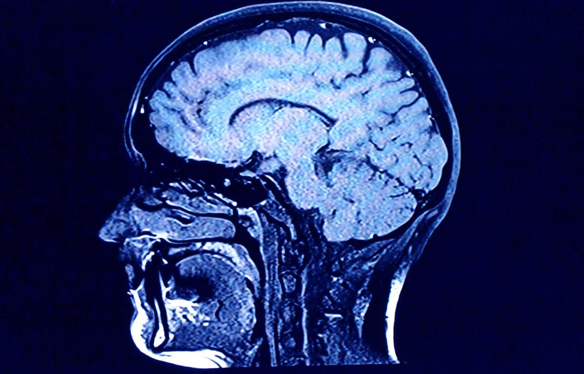 head and brain xray