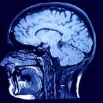 head and brain xray