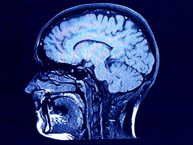 head and brain xray