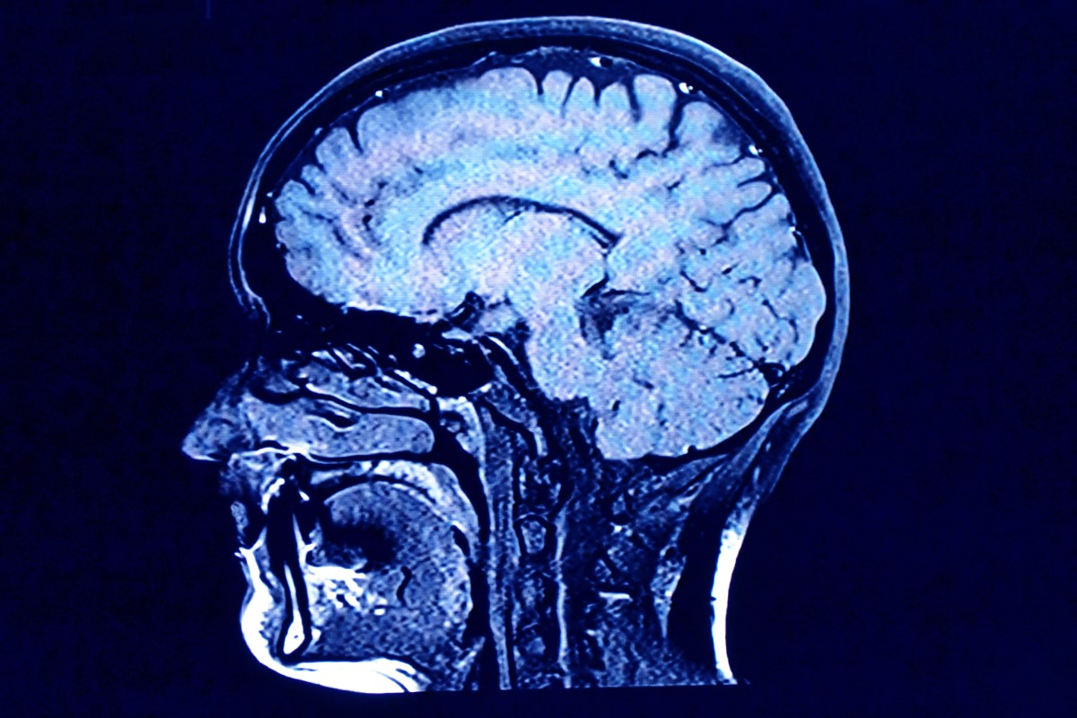 head and brain xray