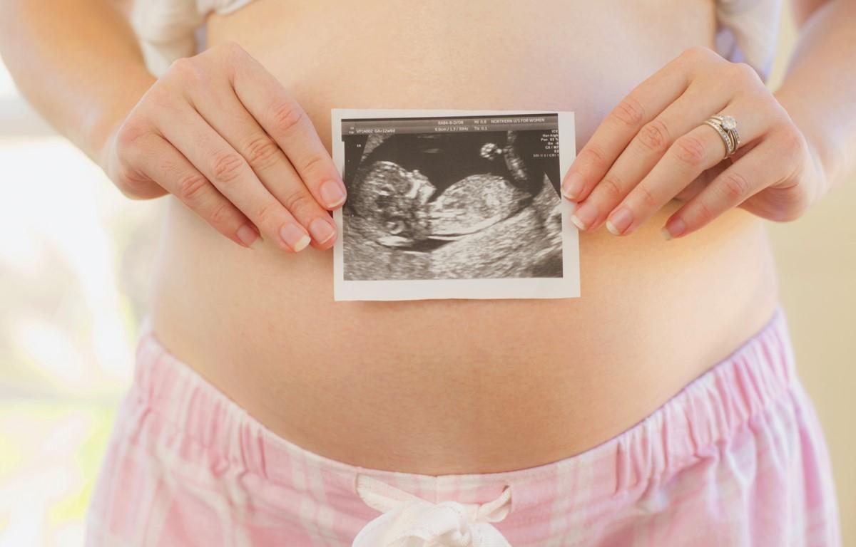 Pregnant woman ultrasound