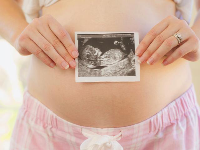 Pregnant woman ultrasound
