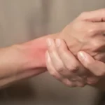 Person's hands clasped around a reddened wrist, indicating wrist pain or strain.
